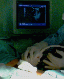 kidney_cancer001013.gif