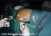 laparoscopy001008.jpg