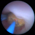 laser_surgery001002.jpg