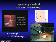 new_therapies_aging_prostate001007.jpg
