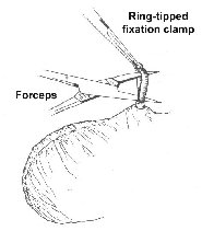 vasectomy001010.jpg